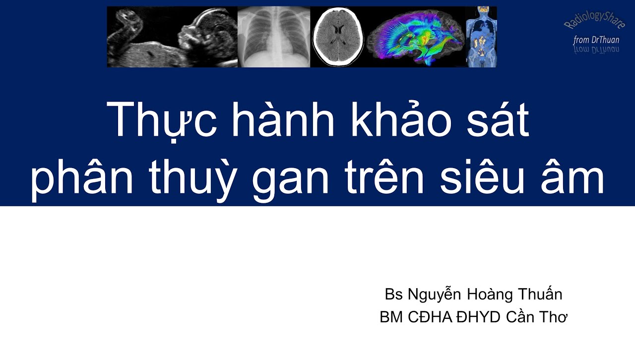 Thực hành khảo sát phân thuỳ gan trên siêu âm