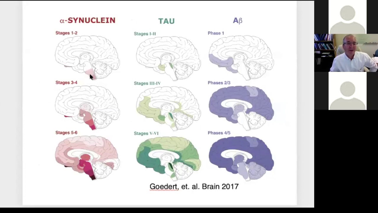 Ask the Experts - Cognitive and Psychiatric Aspects of Parkinson's Disease