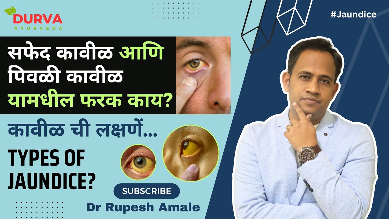 सफेद कावीळ आणि पिवळी कावीळ यामधील फरक काय?  Types of Jaundice? Dr Rupesh Amale