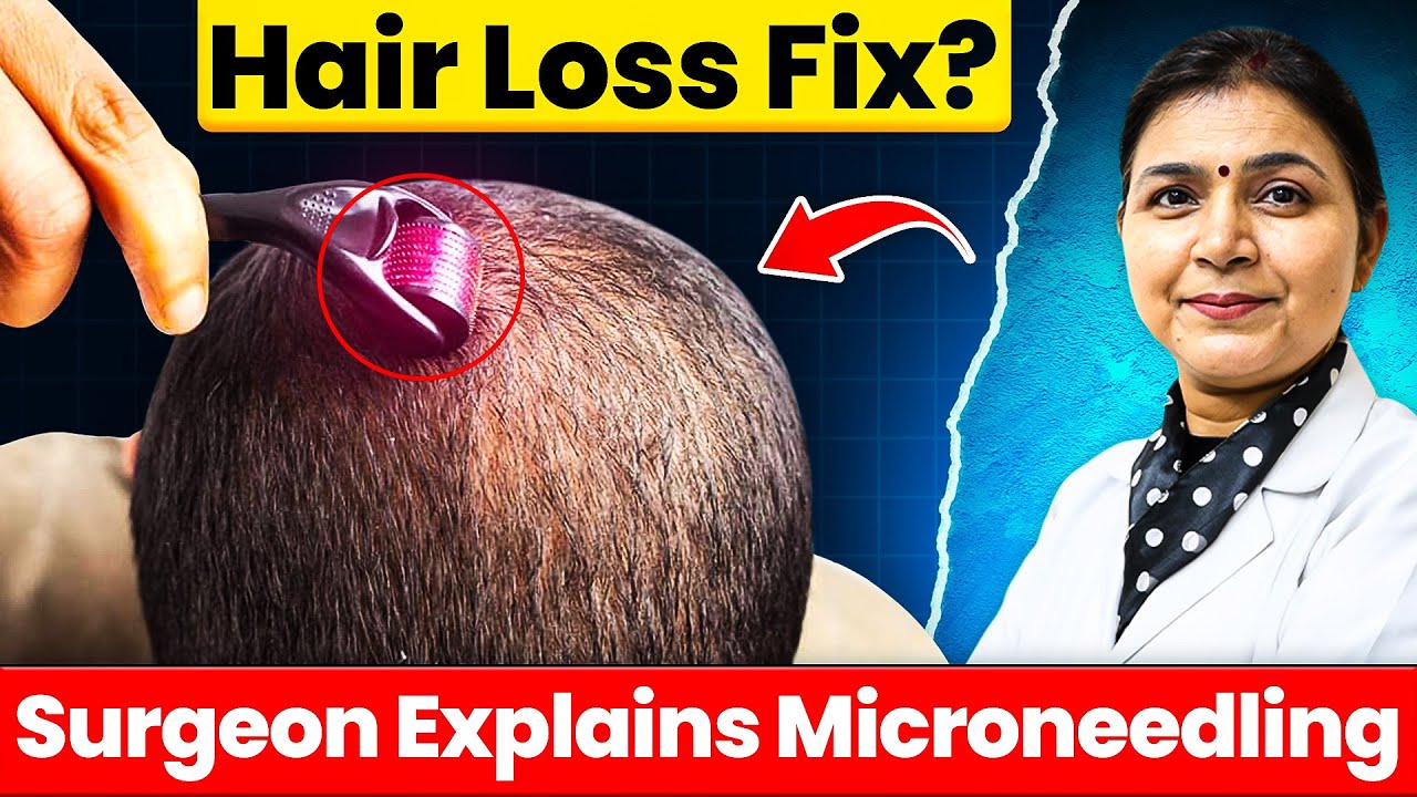 Microneedling for Hair Loss