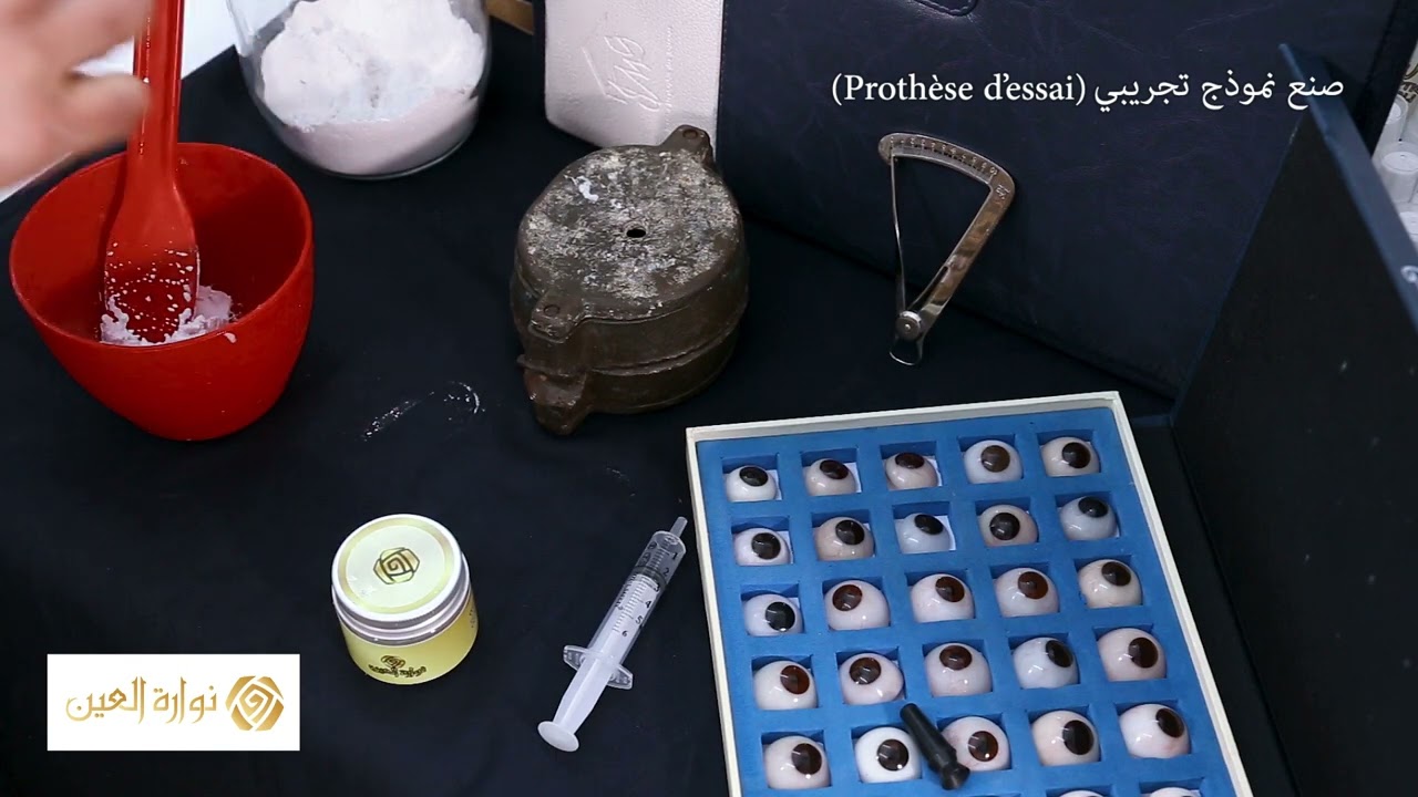 Fabrication de prothèses oculaires sur mesure chez l'oculariste Walid Wali, عيون إصطناعية تعويضية