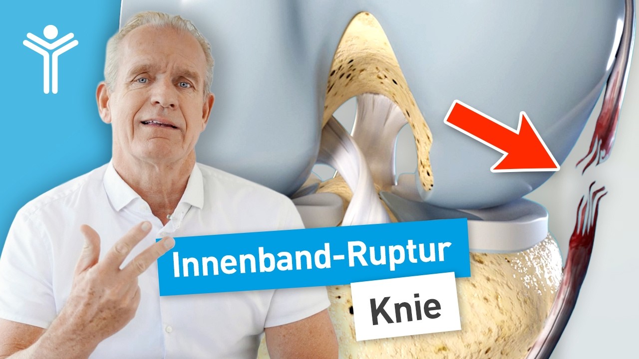 Innenbandriss am Knie - Tipps zur richtigen Behandlung vom Kniespezialisten