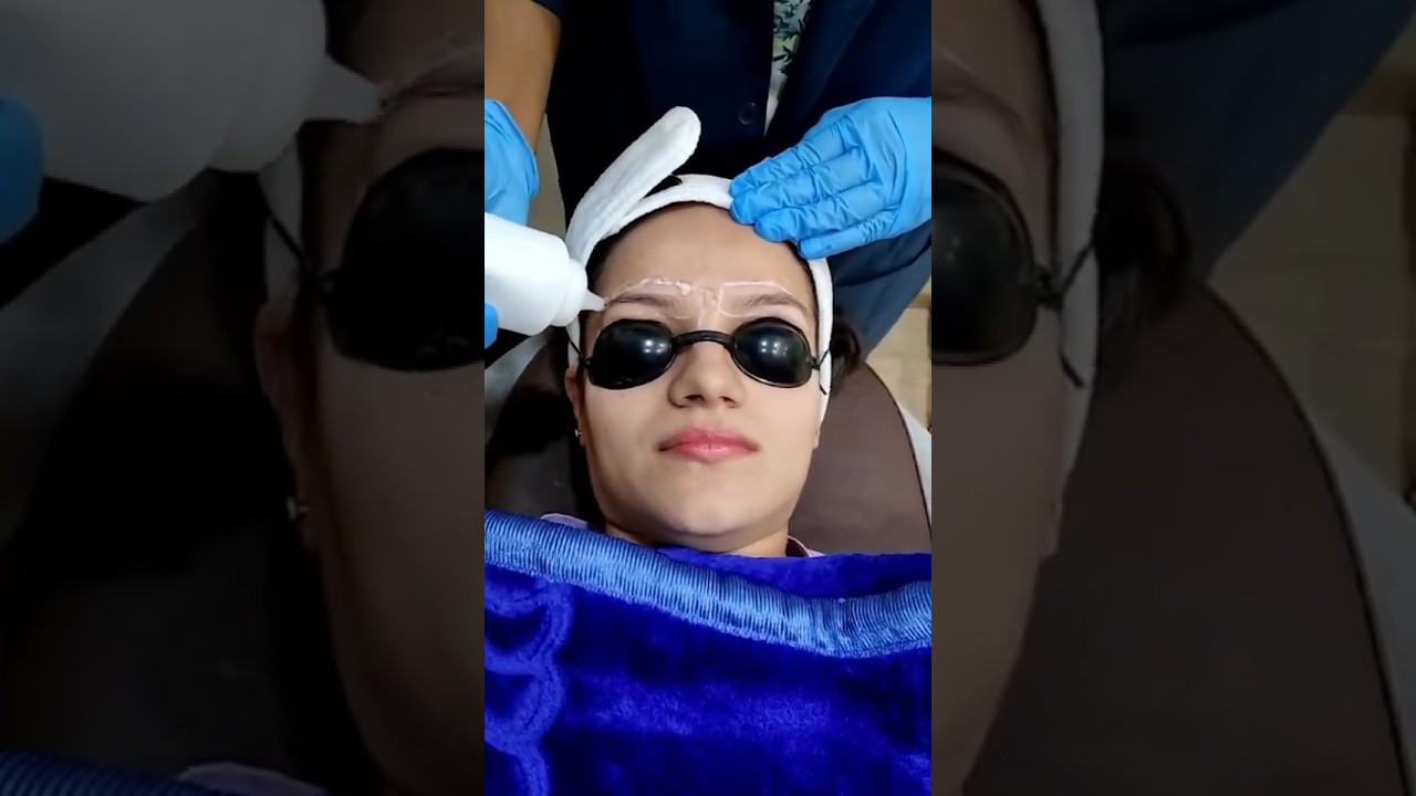 You Won’t Believe Her Skin Transformation! 💥 | Thane’s #1 Skin Clinic – DNA Royal Aesthetics