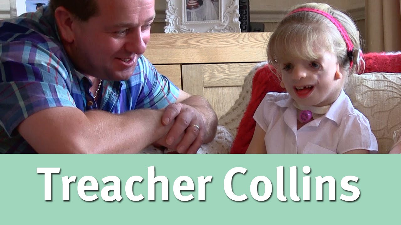 My daughter has Treacher Collins syndrome