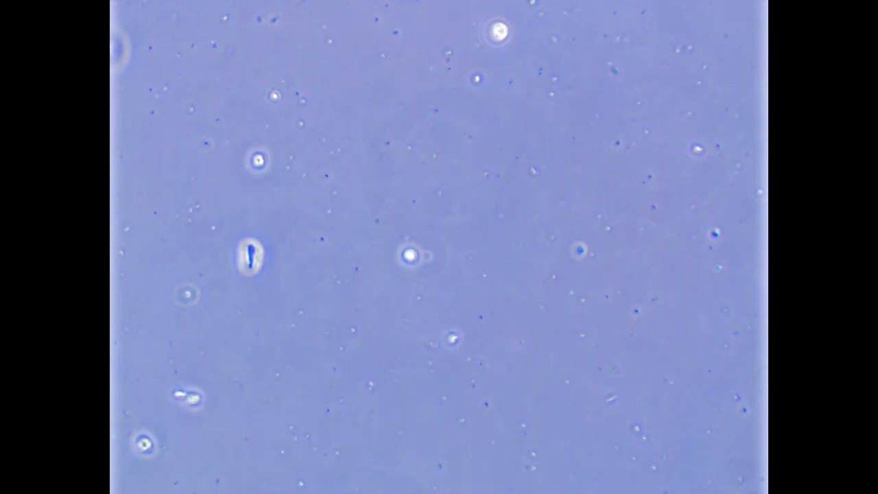 Trichomonas gallinae wola gołębia. Rzęsistek gołębia