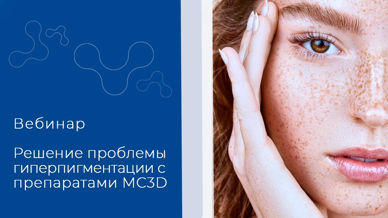 Вебинар. Гиперпигментация