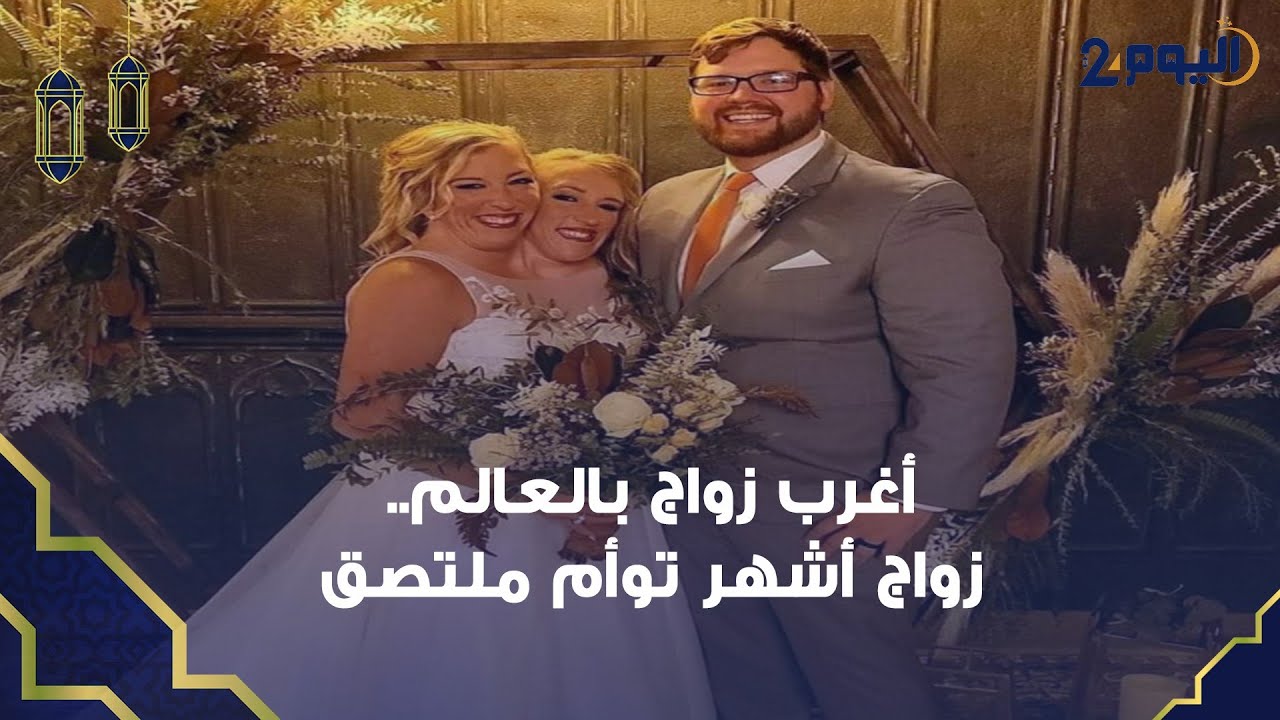 أغرب زواج بالعالم.. زواج أشهر توأم ملتصق من جندي أميركي