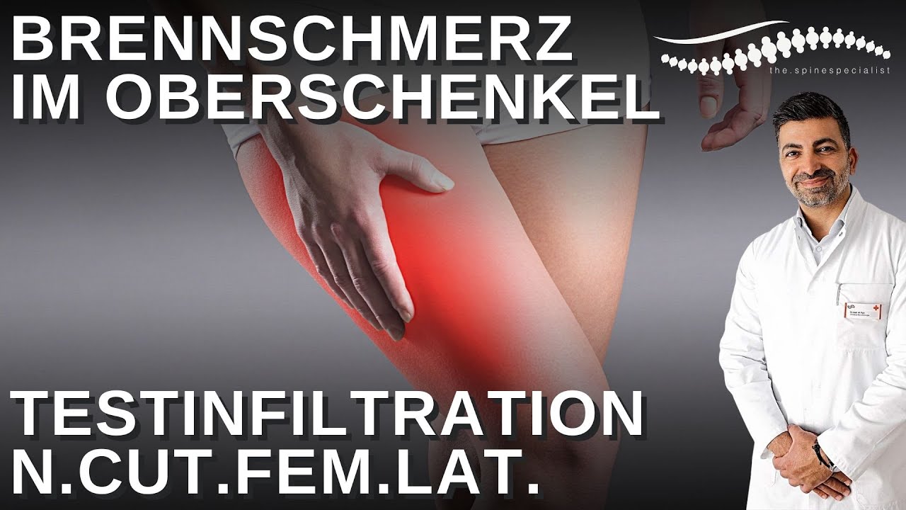 Brennschmerz im Oberschenkel - Meralgia Paraesthetica | Testinfiltration n.cut.fem.lat