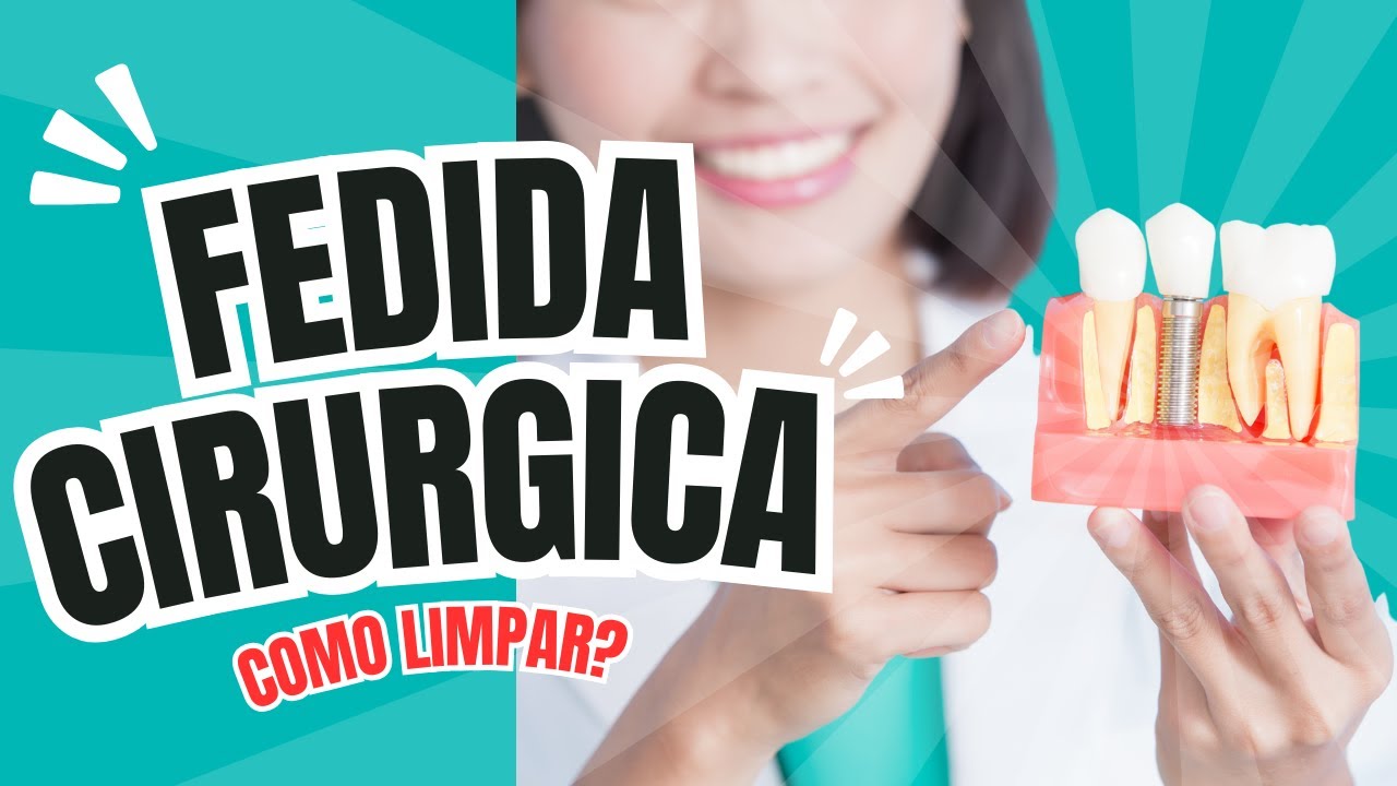 COMO LIMPAR UMA FERIDA CIRÚRGICA APÓS INSTALAÇÃO DOS IMPLANTES.