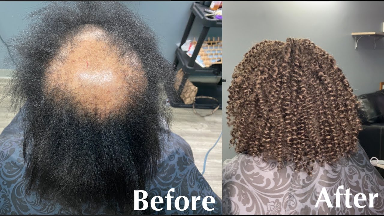 Crochet install on Fine Hair and Hair loss