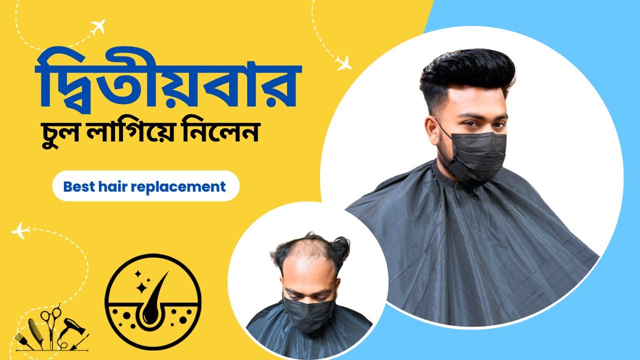 clip system hair replacement | দুই বছর পরে আরও একটি হেয়ার প্যাচ লাগিয়ে নিলেন | hair style int