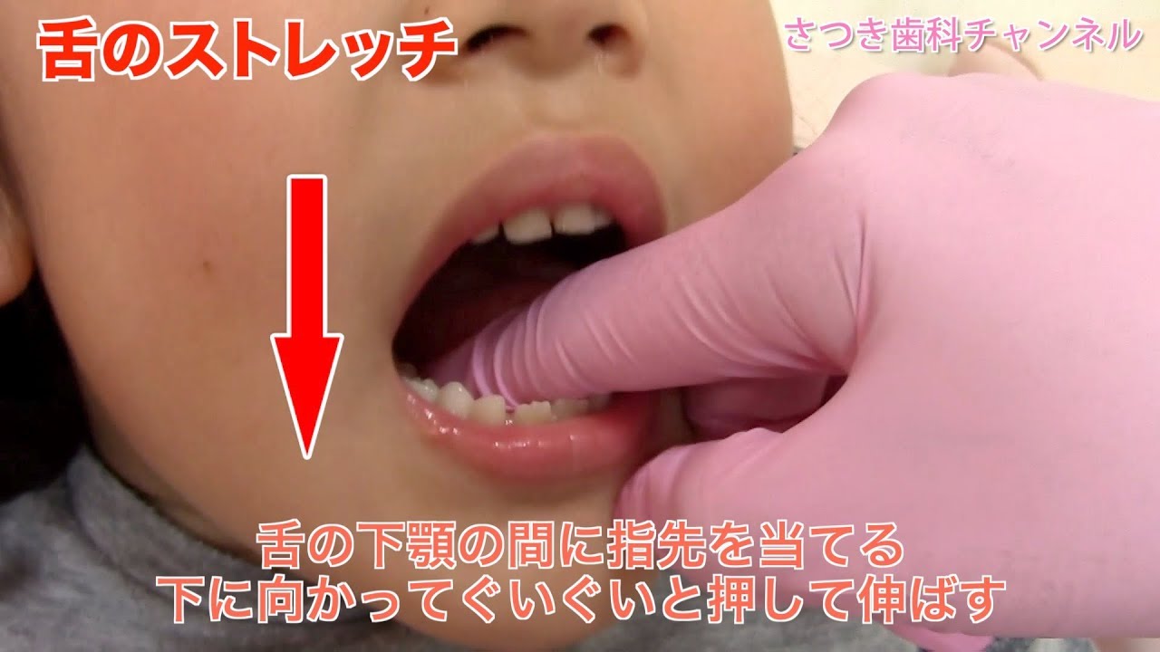 【青森_十和田市_歯医者】こんなにあるの？舌の動きが悪いと引き起こされる問題_さつき歯科チャンネル019（口腔ケアチャンネル）