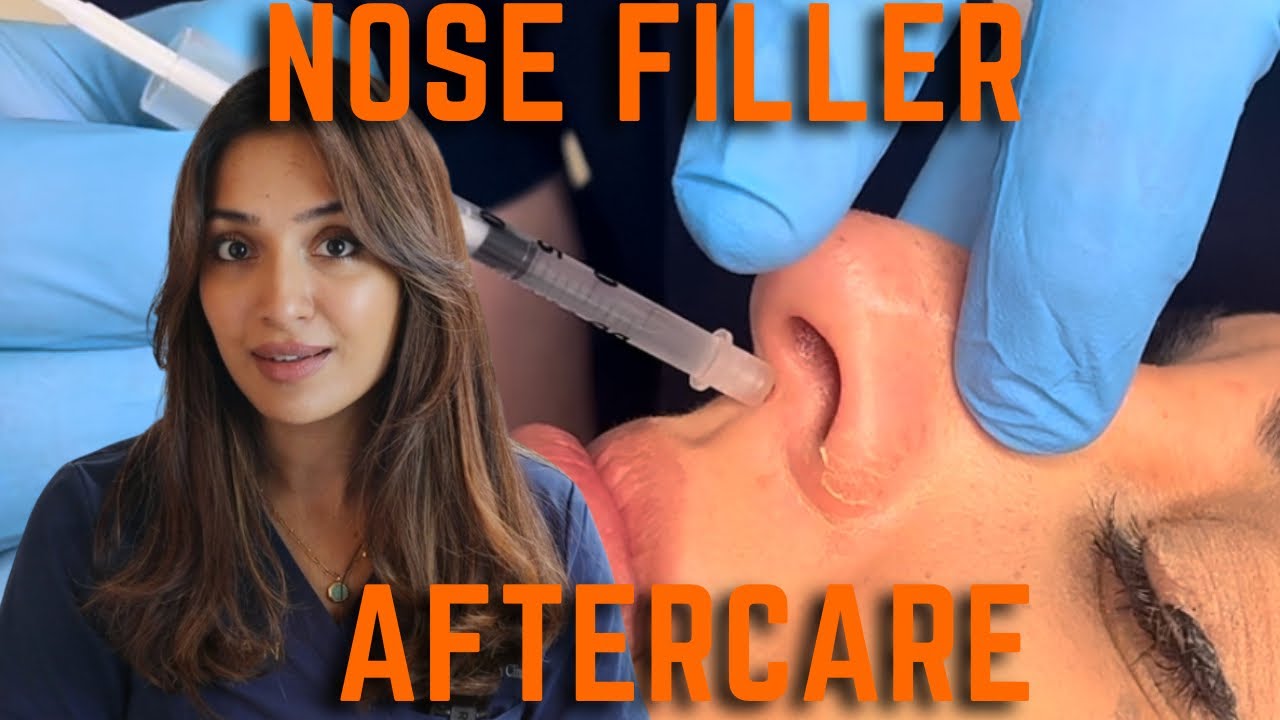 Nose Filler After Care | Long Lasting Non Surgical Rhinoplasty