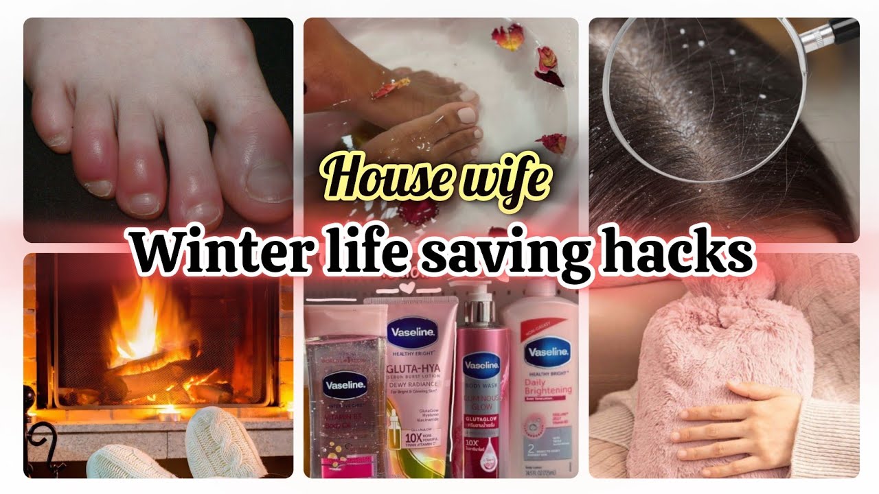 10 Winter Life Saving Hacks You Must Try Everyday Hacks To Groom & Protect Yourself In Winter