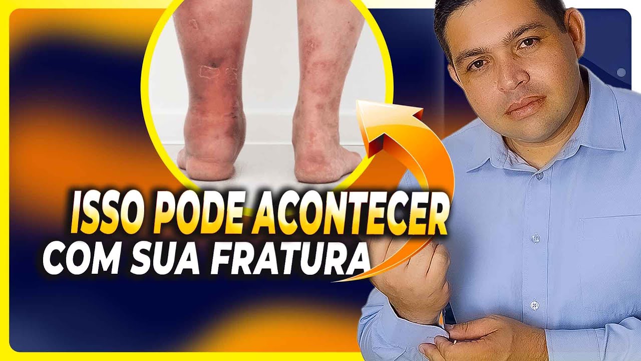 VOCÊ  SABIA: ISSO PODE ACONTECER COM SUA FRATURA?