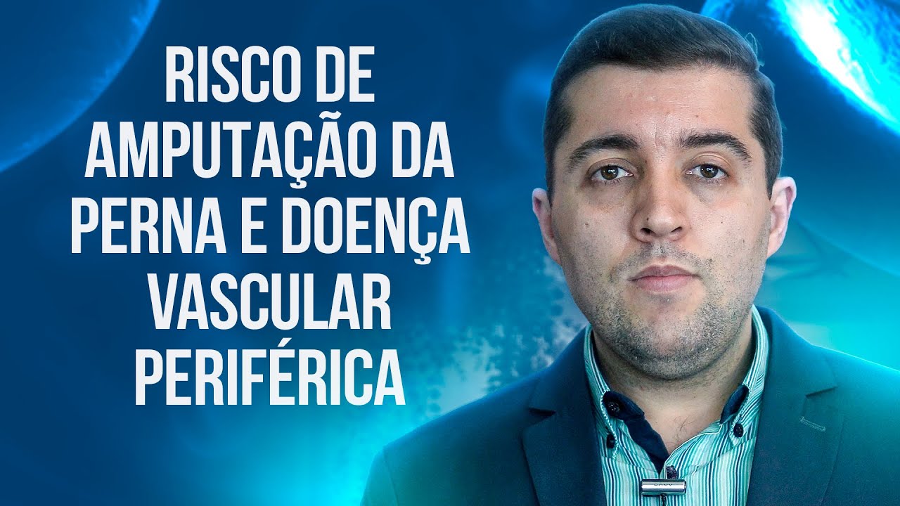 M&aacute; circula&ccedil;&atilde;o que pode causar amputa&ccedil;&atilde;o da perna: conhe&ccedil;a a doen&ccedil;a arterial obstrutiva perif&eacute;rica