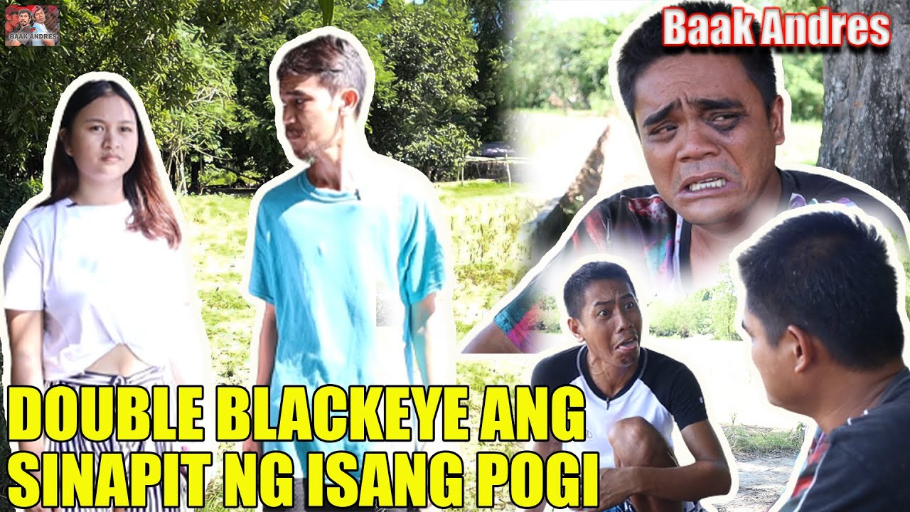 Double black eye ang sinapit ng isang pogi - Baak Andres