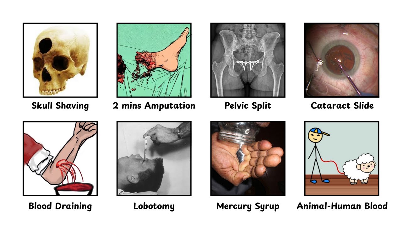 The Most Fatal Medical Procedures Ever
