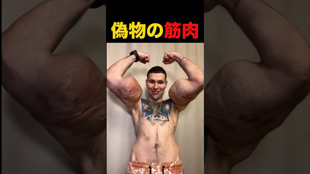 腕にワセリンを注射して詰んだ！#shorts