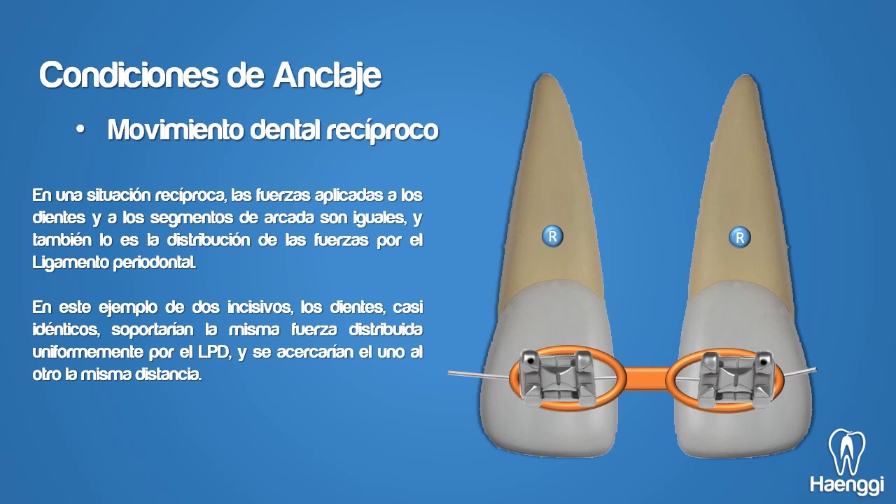 Clase de Anclaje (generalidades)