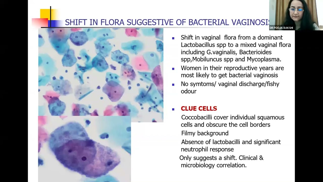 CDE Series 7 - Cervical Cytology and HPV : Infectious and Glandular Lesions on Cytology