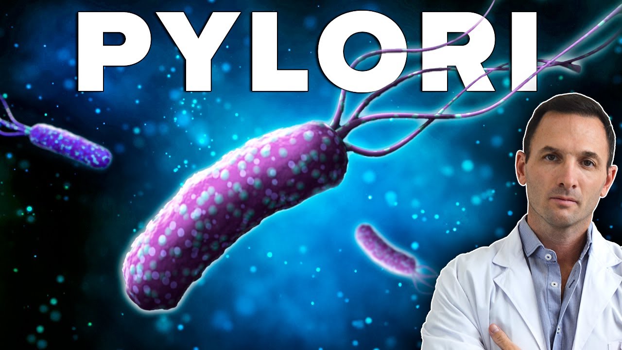 El Helicobacter Pylori Puede Estar Detrás de Tu Dolor de Espalda