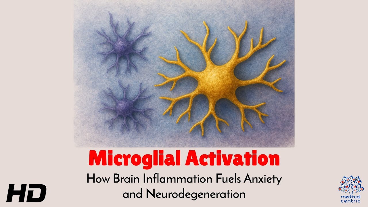 Microglial Activation : How Brain Inflammation Fuels Anxiety and Neurodegeneration