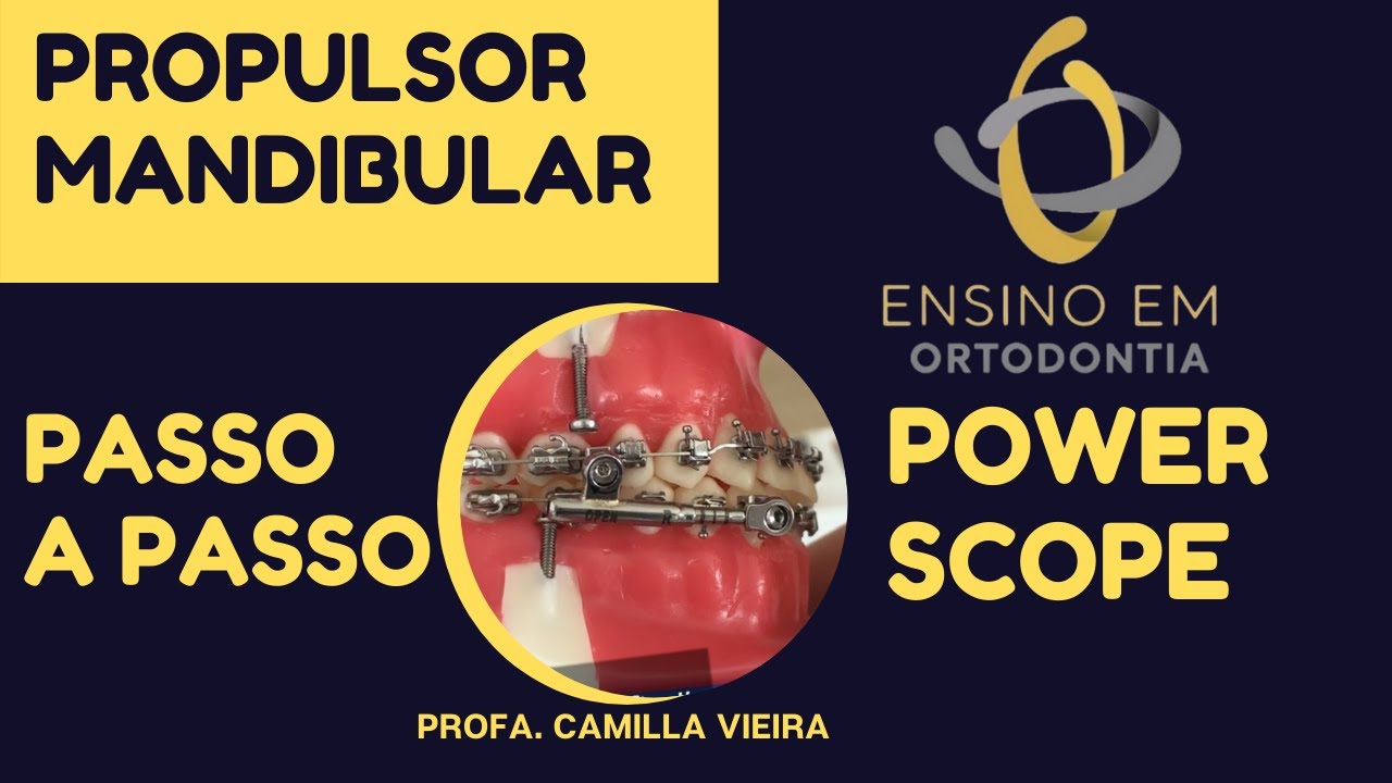 Instalação Propulsor Mandibular Power Scope