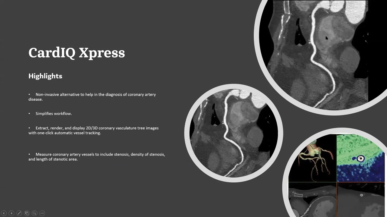 Module 4   Post Processing - Webinar Multislice CT