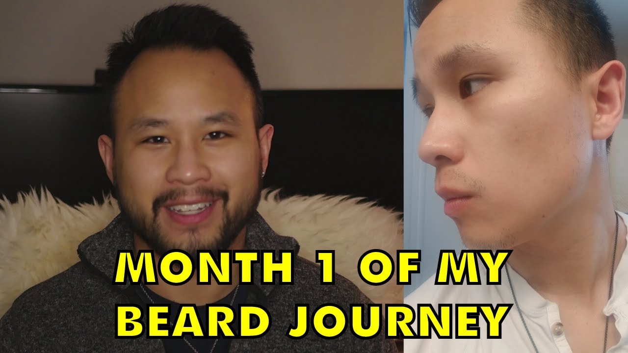Minoxidil Beard | Month 1 of my Beard Journey