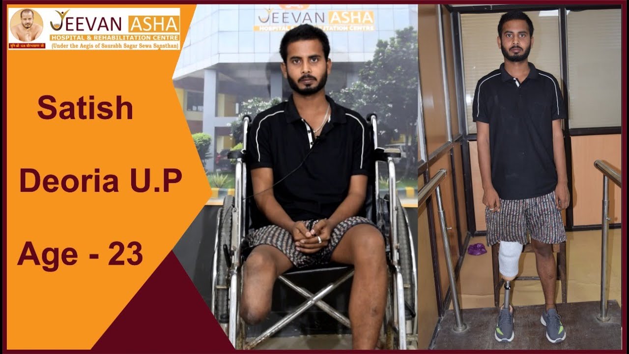Satish from Uttar pardesh lost his right leg below knee in a train accident