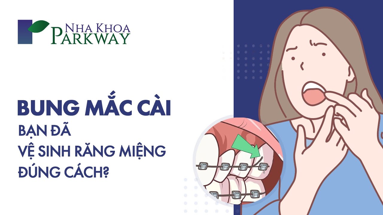 VỆ SINH RĂNG MIỆNG KHI NIỀNG | NHỮNG THÓI QUEN SAI LẦM VÀ CÁCH KHẮC PHỤC