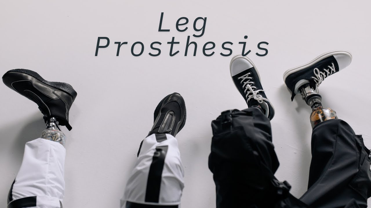 Lower Leg Prosthesis Making Process | Oslo Norway @FromTanzaniatoNorway