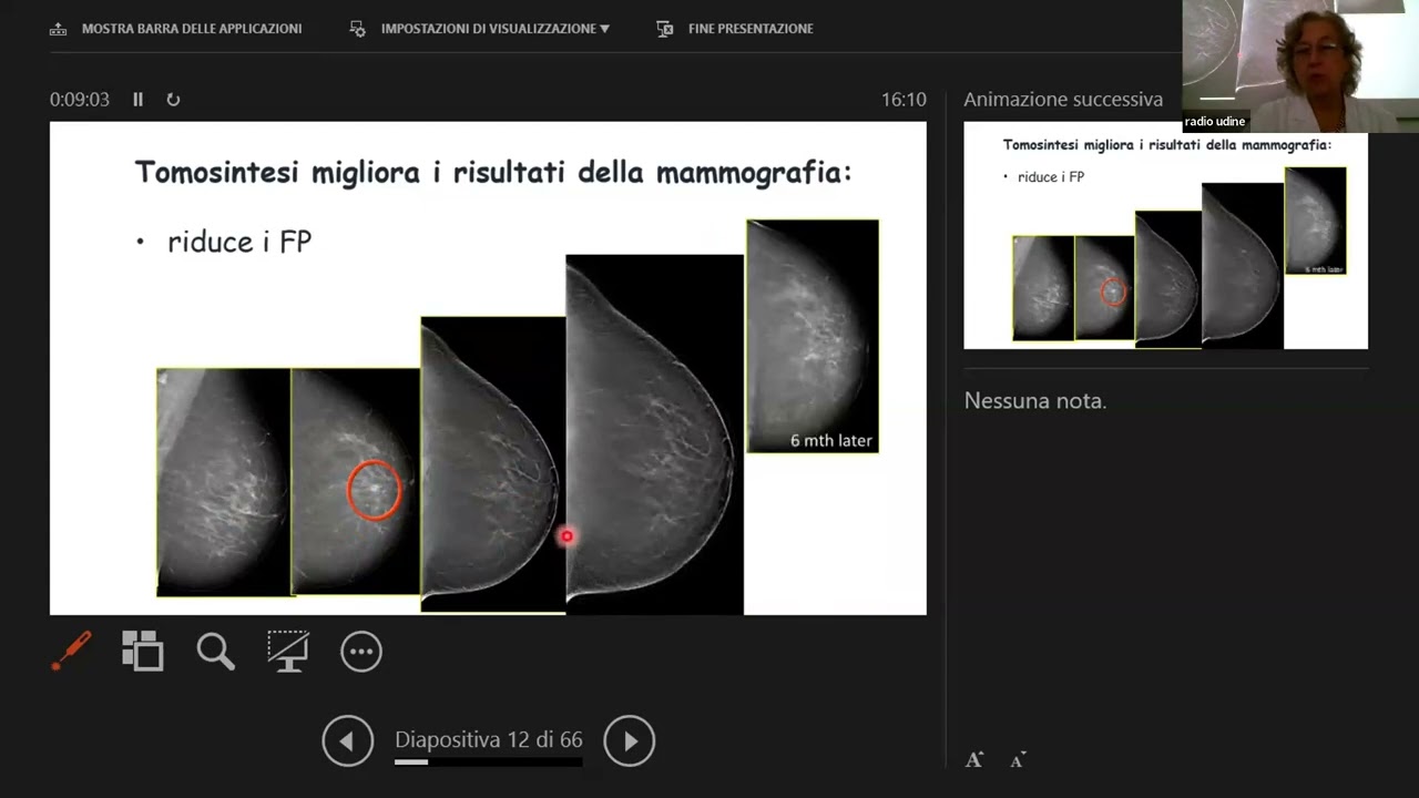 23.6) Le neoplasie della mammella - Prof.ssa Zuiani e Prof. Sardanelli, Presenta Prof. Belli