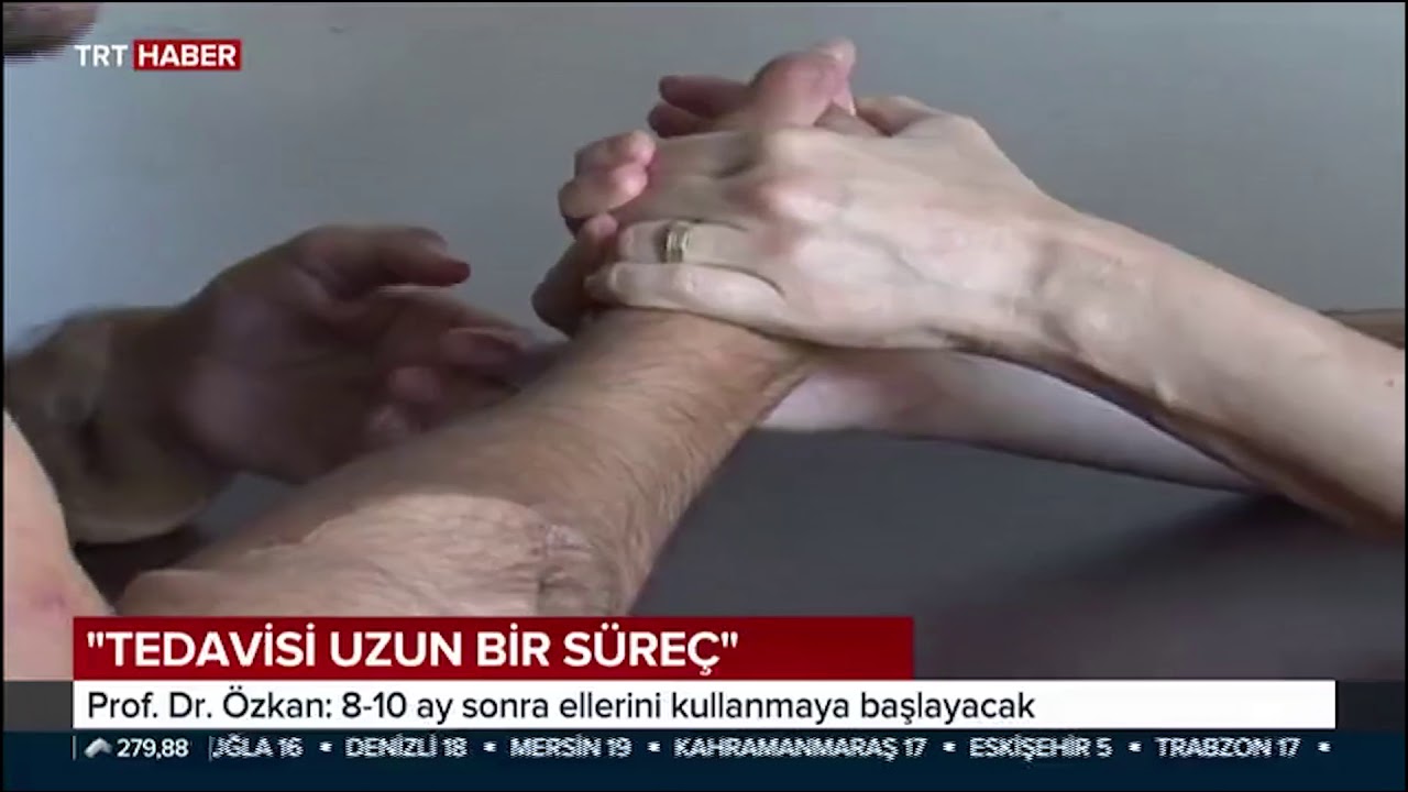 Kol Naklinde Kritik Süreç Aşıldı