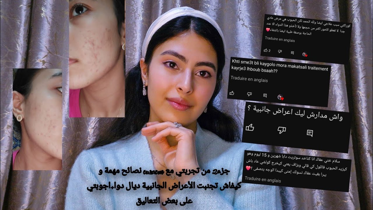 جزء2 من تجربتي مع curacne نصائح مهمة و كيفاش تجنبت الأعراض الجانبية ديال دوا+اجوبتي على بعض التعاليق