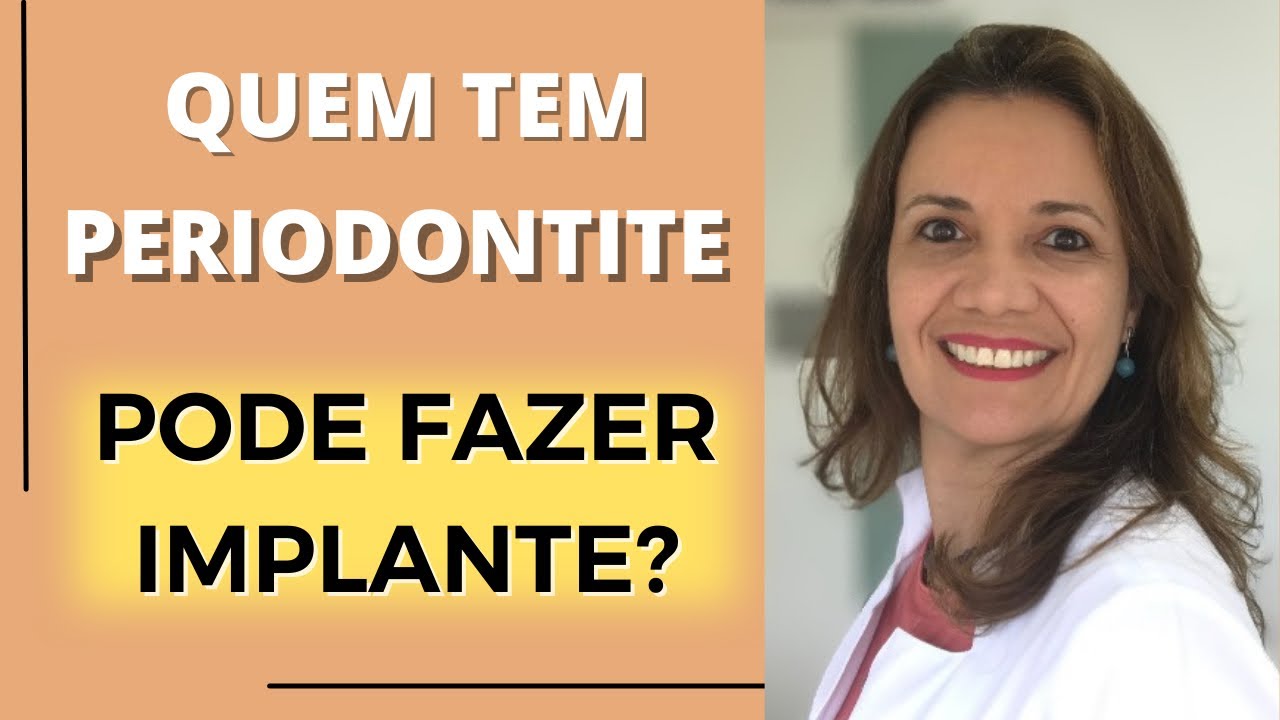 QUEM TEM DOENÇA PERIODONTAL PODE FAZER IMPLANTE? - DRA. MELISSA LUCENA