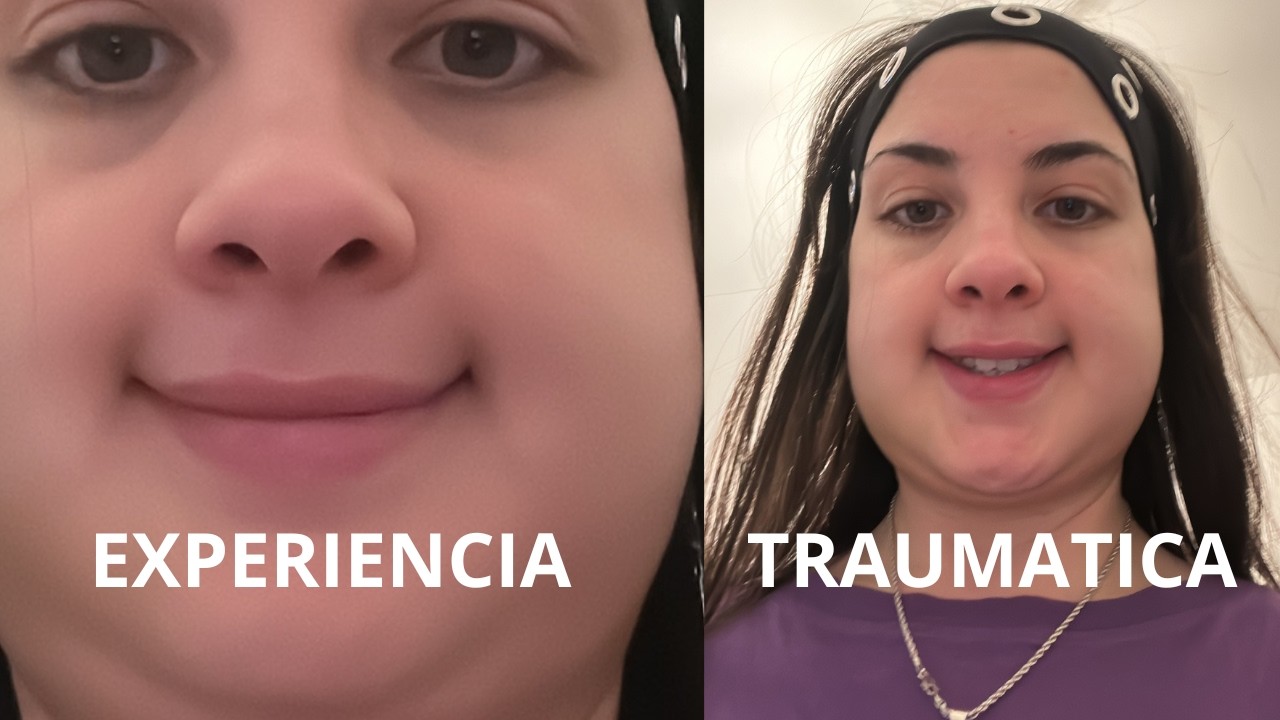 Me sacaron las 4 muelas de juicio y esto fue lo que me hicieron