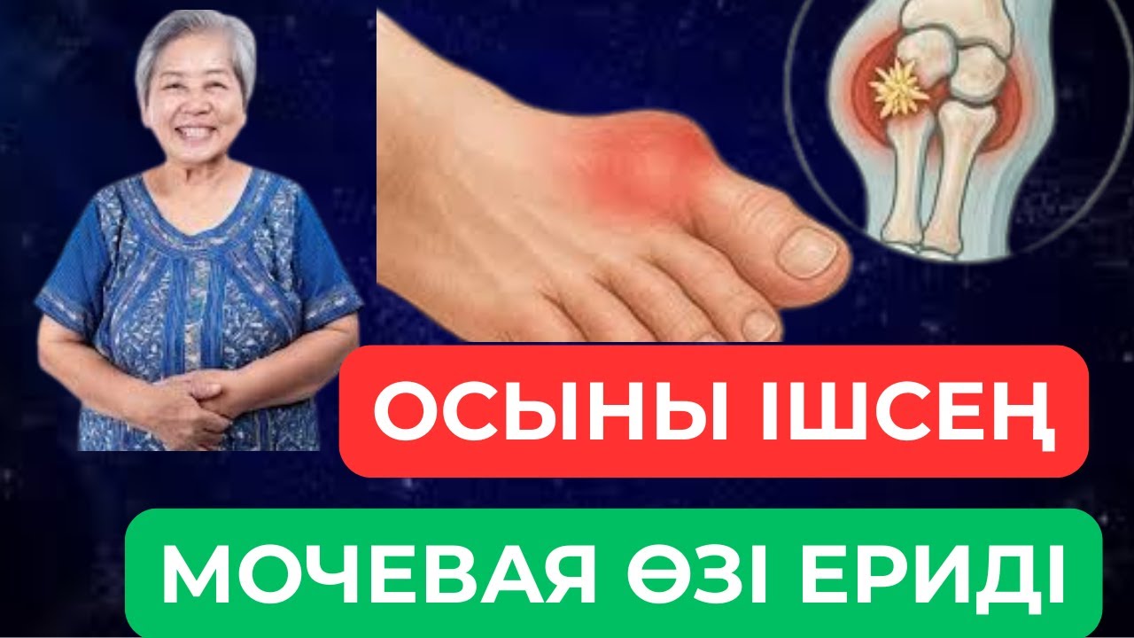 Буын ауруын 1 күнде тоқтату мүмкін бе? Мұны білгеніңіз жөн! #қазақшамедицина#халықемі#буынауруы
