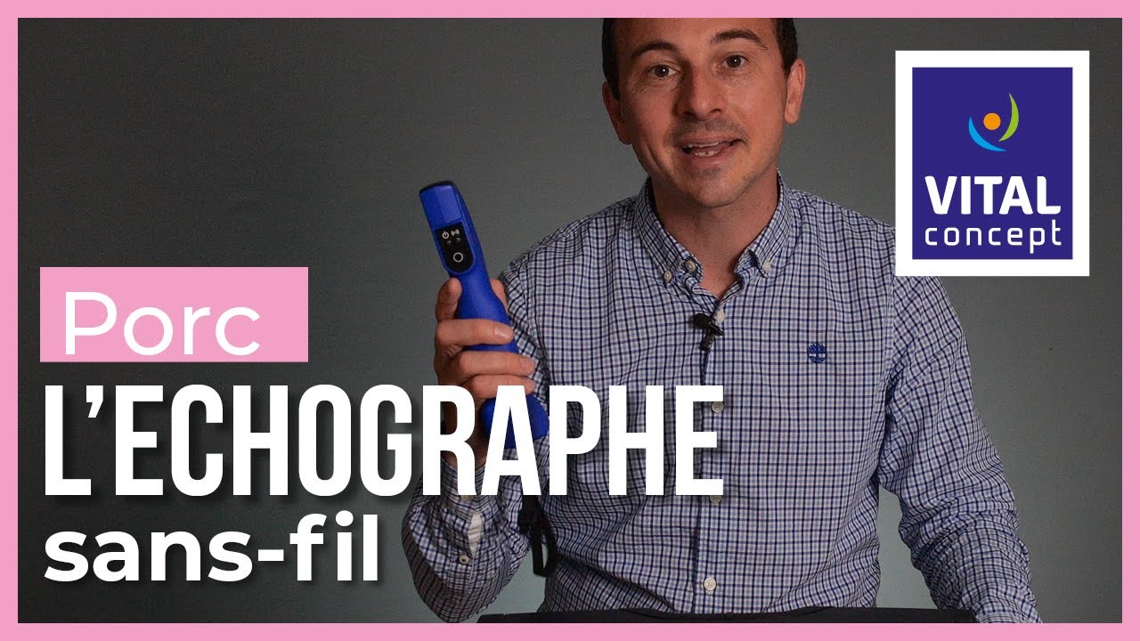 Duo Scan-Go : simplifier l'acte échographique !