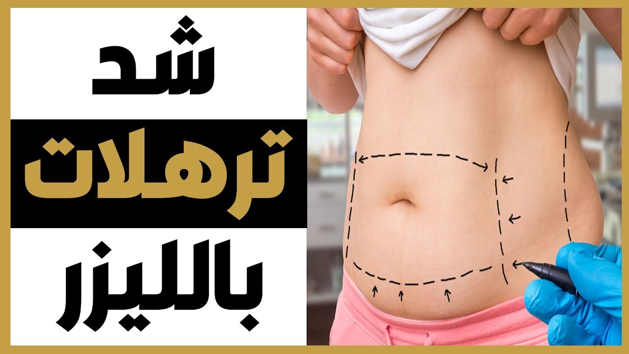 شد ترهلات الجسم بالليزر أحدث التقنيات والنتائج والفوائد والأضرار مع دكتور أحمد السبكي