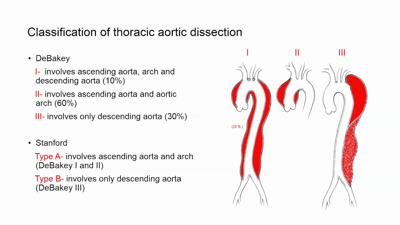 Anesthesia Considerations for TAA Dissection  - Dr. Klimkina