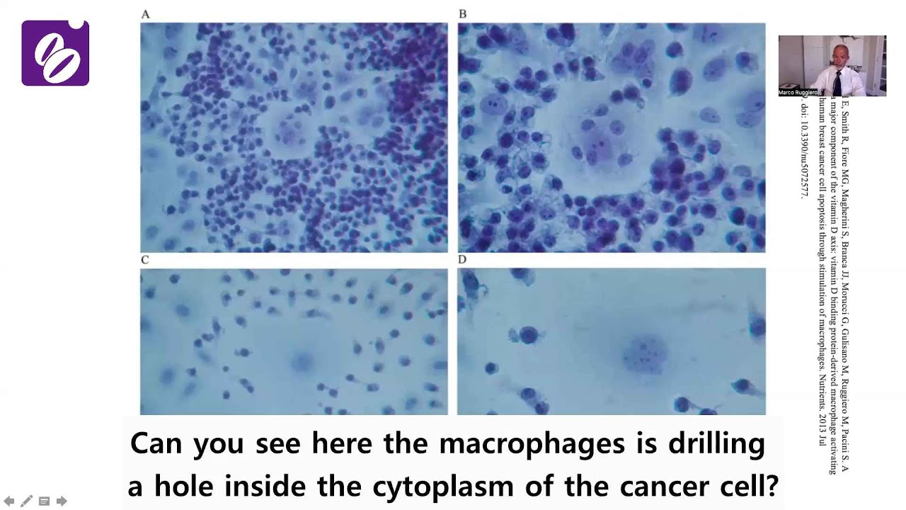 Dr. Marco Ruggiero's amazing new invention, the 1VAR (LCSP complexes, Microbiome) - Part1. (ENG Sub)
