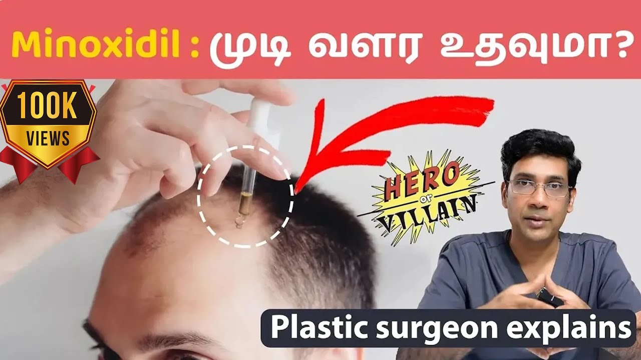 முடி வளர்ச்சிக்கு மினாக்ஸிடில் எப்படி பயன்படுத்துவது? Minoxidil || Hair Loss clinic coimbatore.