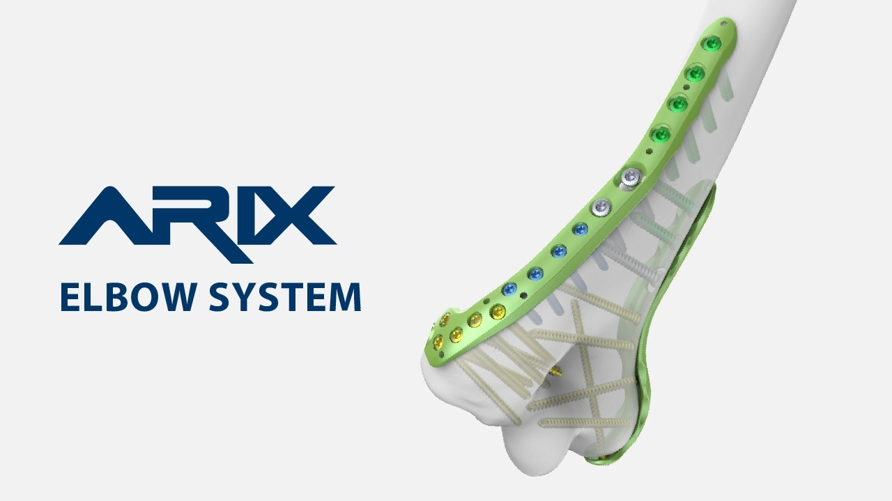 [ARIX OS] ARIX Elbow - Distal Humerus Surgical Guide