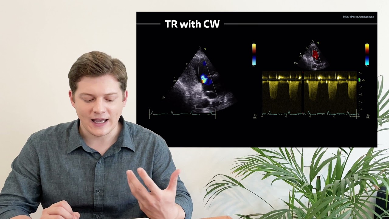 〖Echocardiography〗 Parasternal Long Axis View (PLAX) part 4 - atypical views 2