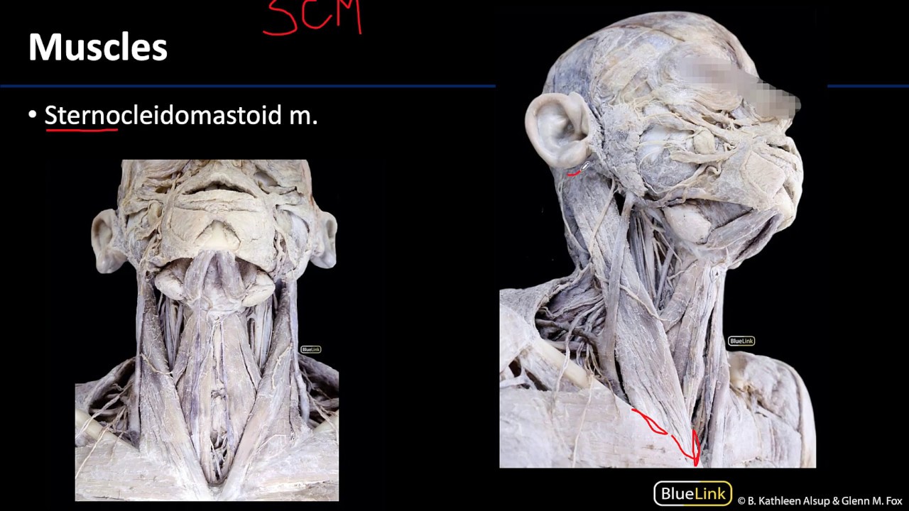 Anterior Neck - Muscles