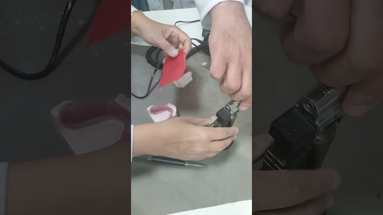 Bite rim for R.P.D
