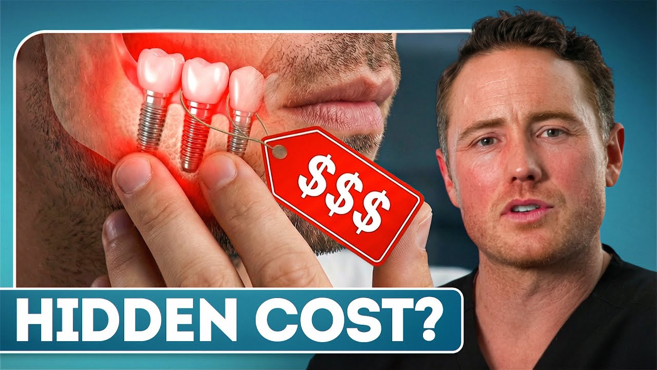 All Your Dental Implant Questions - What’s the REAL Cost?