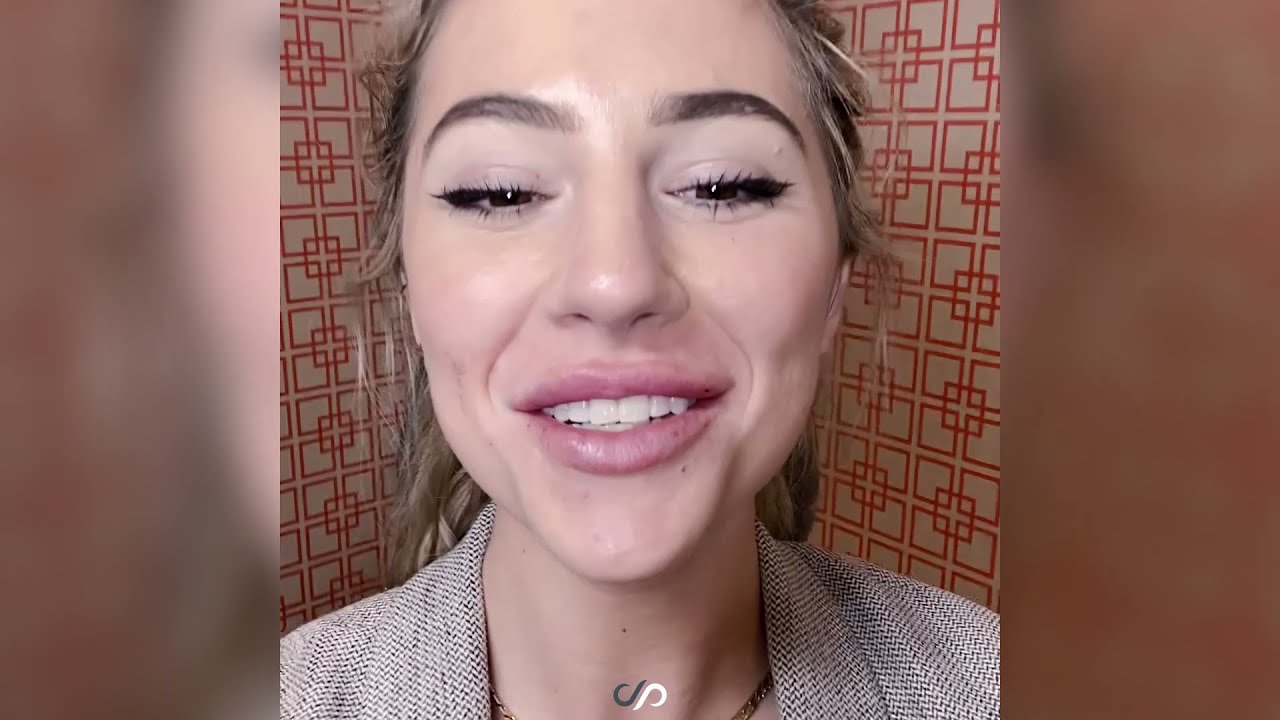 First Time Lip Filler With Stoker Aesthetics | Los Angeles